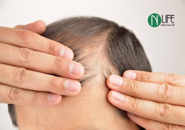 تقویت فولیکول های مو ، جلوگیری از ریزش مو و کمک به رشد مجدد آن